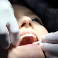 Is Dental Care Free in the UK for Over 60s?